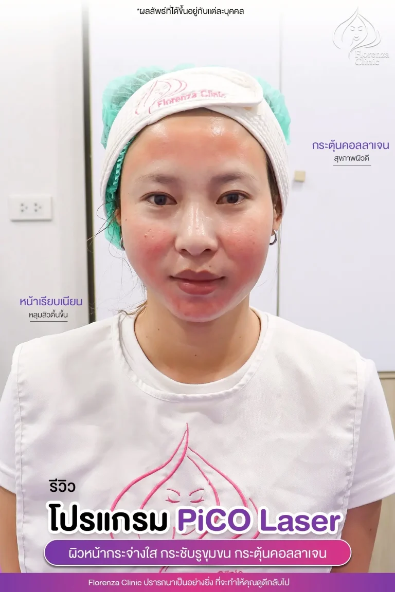 รีวิว Pico